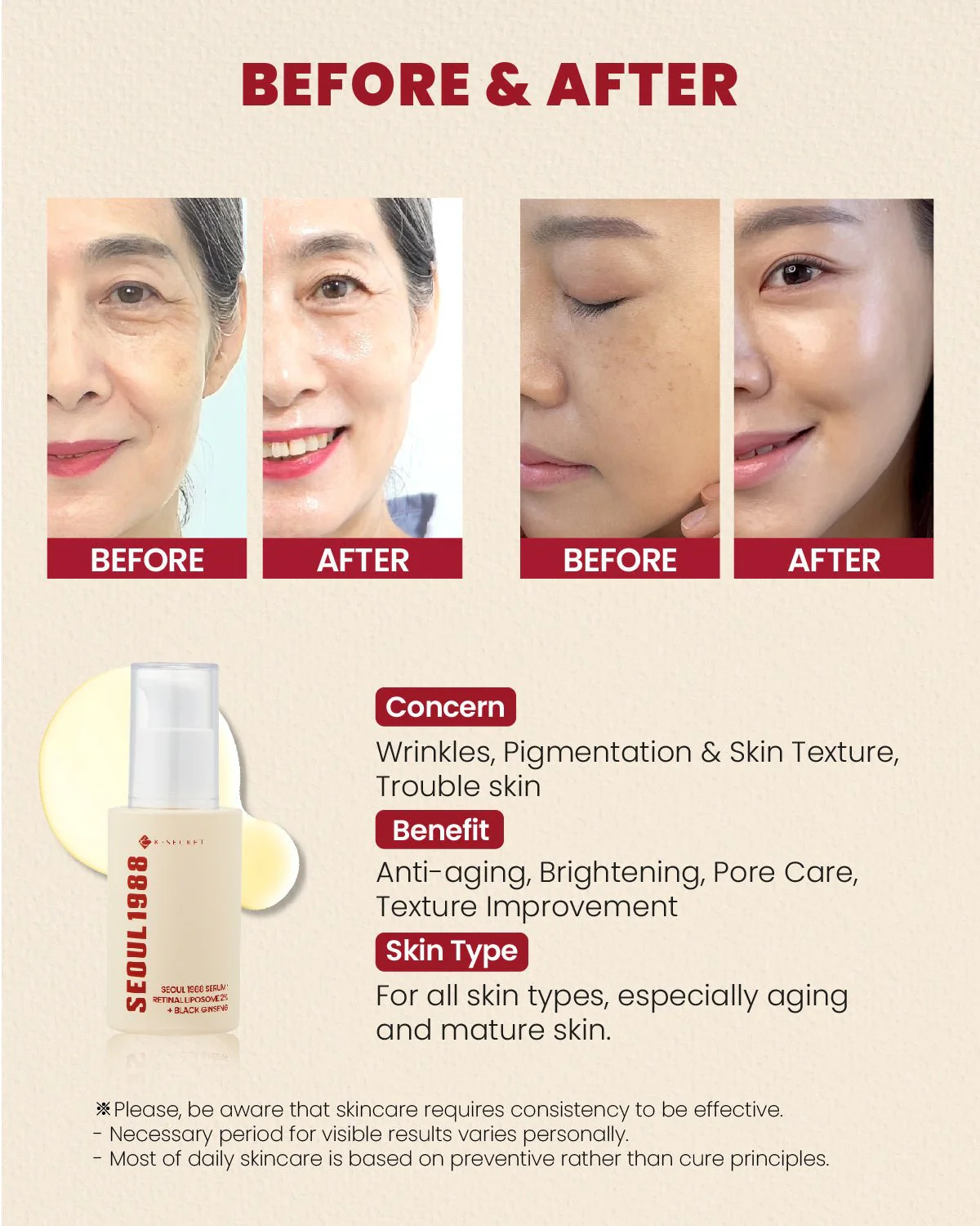 KSecret Seoul 1988 Serum: Retinal Liposome 2% + Black Ginseng 30ml